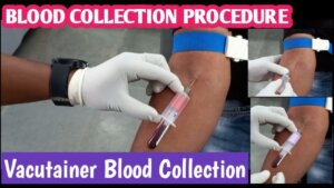 Blood Collection Tube - The basics 10 venipuncture